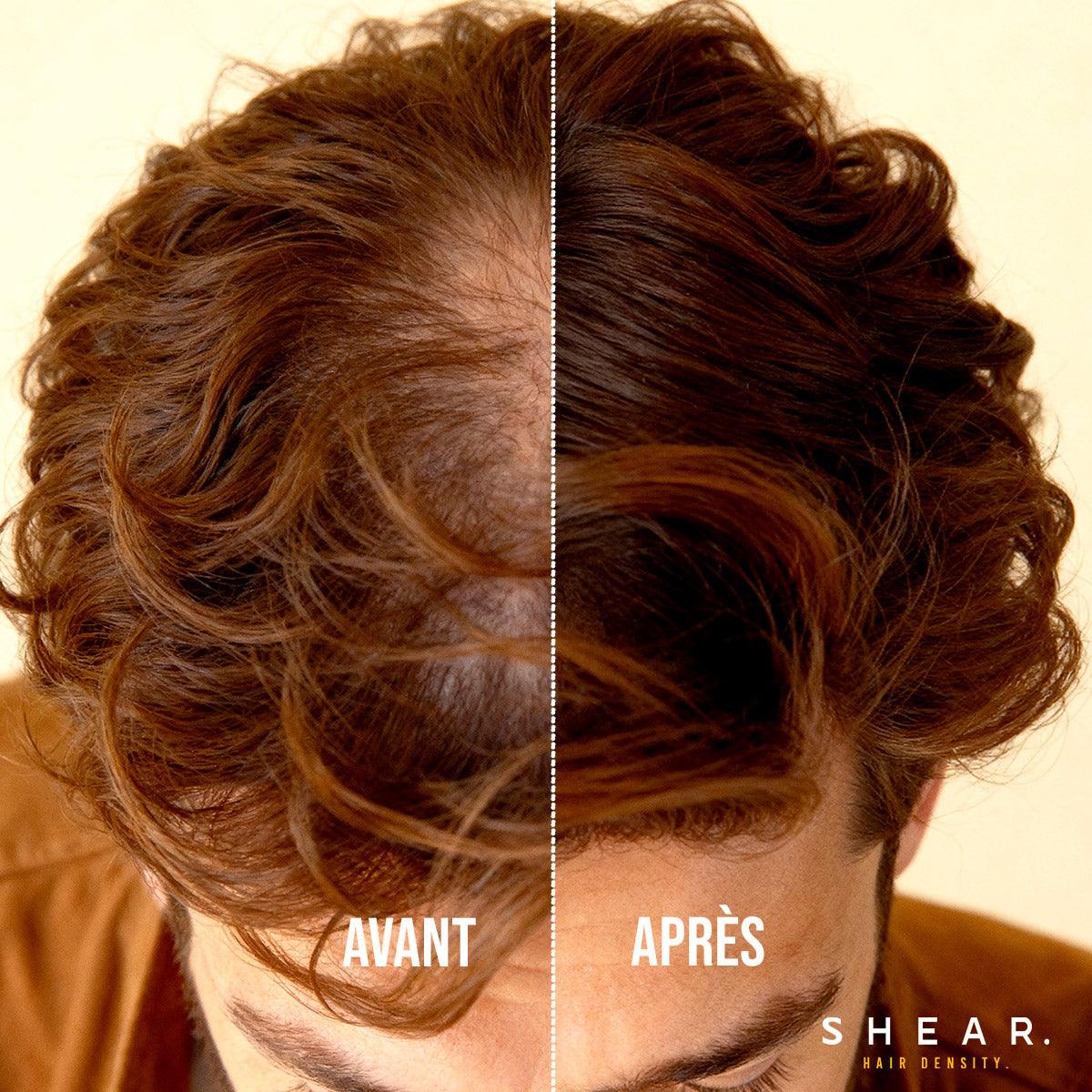 Avant après utilisation de la poudre retouche racine SHEAR - cheveux clairsemés densifiés et couvrance naturelle