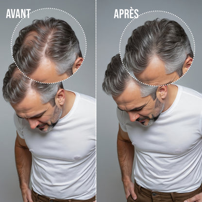 Résultat avant après avec la Poudre Densifiante Capillaire SHEAR® 28g – cheveux clairsemés densifiés instantanément