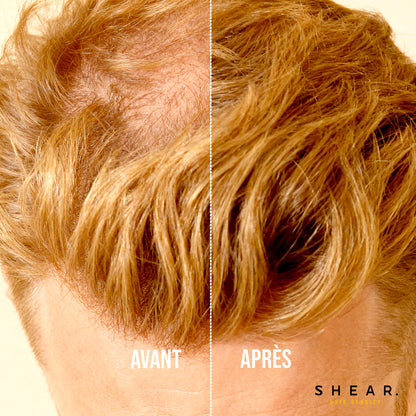 Résultat avant après de la poudre retouche racine capillaire SHEAR 10g - camoufle zones dégarnies, repousses et recul de la ligne frontale