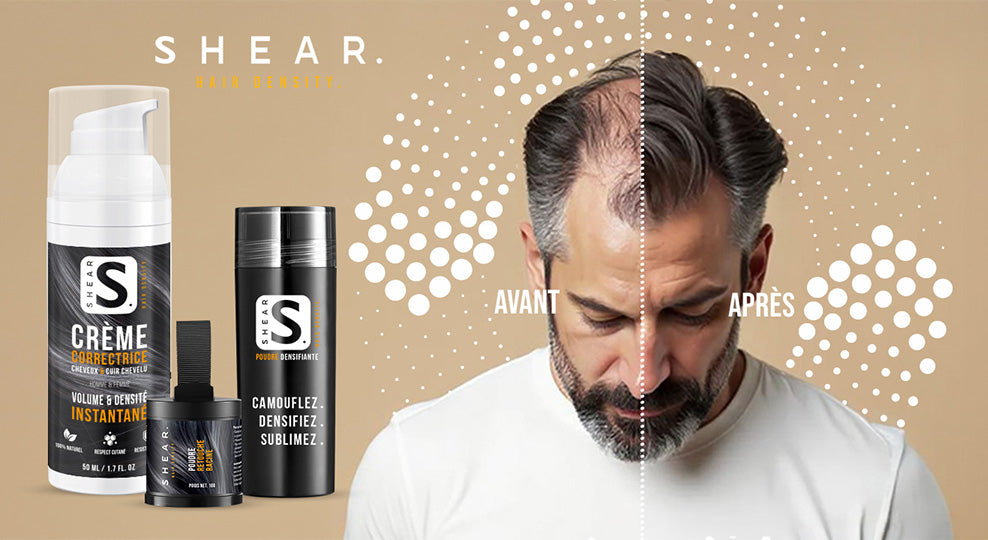 Shear la référence en correction capillaire - avant après perte de cheveux avec poudre densifiante et crème correctrice